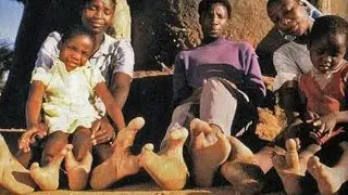 Suku Vadoma : Kaki Penduduknya Menyerupai Kaki Burung Unta