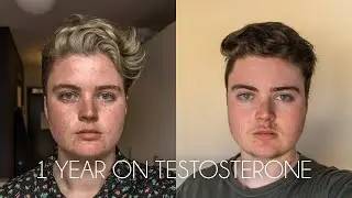 1 YEAR ON TESTOSTERONE COMPARISON // FTM Transgender