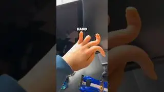Schau was mit meinen Händen ist 🤢🤕