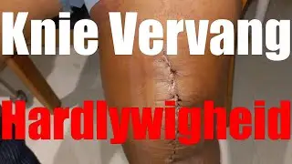 Totale knie vervanging # Hardlywigheid na operasie