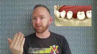 Do you need fake gum on your dental prosthetics?