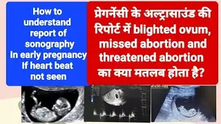 blighted ovum, Incomplete or missed abortion का ultrasound रिपोर्ट मे क्या मतलब होता है?