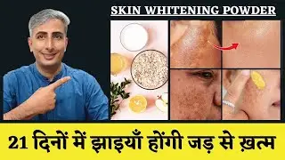 How to remove Pigmentation Naturally I कितने भी गहरे दाग धब्बे हो जायेंगे गायब I DR. MANOJ DAS
