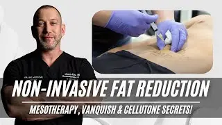 Non-Invasive Fat Loss: Mesotherapy, Vanquish & Cellutone Secrets!