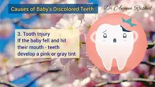 Baby Teeth Discolored - Causes & Solution | Newborn Caring Tips