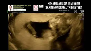14 weeks pregnant, 1st trimester