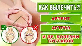 Лечение артрита ревматоидного артрита и артроза в домашних условиях