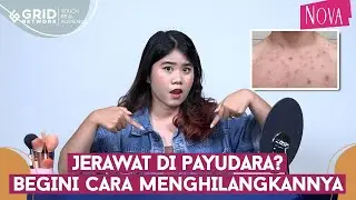 Cara Menghilangkan Jerawat di Payudara, Kulit Kembali Mulus dan Tidak Belang