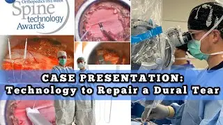 𝐑𝐞𝐩𝐚𝐢𝐫 𝐚 𝐒𝐩𝐢𝐧𝐚𝐥 𝐅𝐥𝐮𝐢𝐝 𝐋𝐞𝐚𝐤 Technology