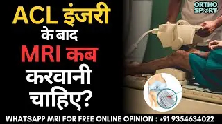 ACL लिगामेंट इंजरी के बाद MRI स्कैन कब करवाना चाहिए | When to get MRI Scan after Ligament Injury