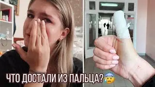 VLOG Сделали операцию на пальце...