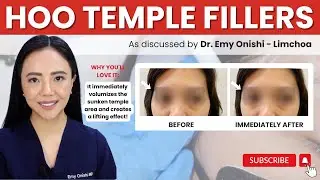 EVERYTHING YOU NEED TO KNOW ABOUT TEMPLE FILLERS