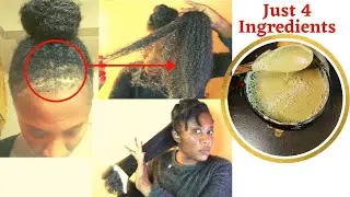 4 Basic ingrediente: Use this Cleansing Shampoo every wash day to Regrow  bald spots & Repair Hair.
