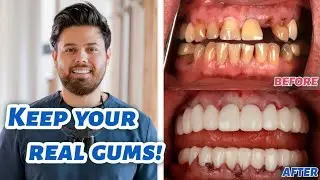 Better than All-on-4! A 3 on 6™ Dental Provider in New York!