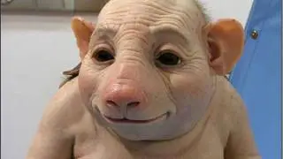 Sequelas Da Gripe Suina!
