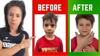 Jawline Exercises - Diamond Face vs Square Jaw Line - Posturepro