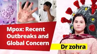 Mpox: Recent Outbreaks and Global Concern