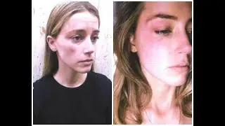 Policía DESMIENTE a Amber Heard - "NO VÍ  NINGUNA HERIDA!"