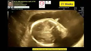 21 weeks
