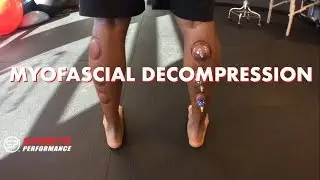 Cupping Therapy for the Foot, Ankle and Calf | Sports Performance Physical Therapy | San Diego, CA