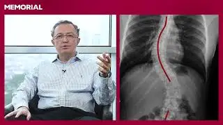 Skolyoz nedir? - Prof. Dr. Emre Acaroğlu (Ortopedi ve Travmatoloji Uzmanı)
