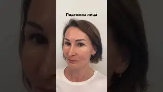 Фейслифт | Л. С. Украинский