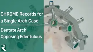 CHROME Records for single arch case: Dentate surgical arch, with opposing Edentulous