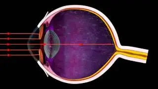 How the Iris Controls Light Entering the Eye - 3D Medical Animation Eye || ABP ©