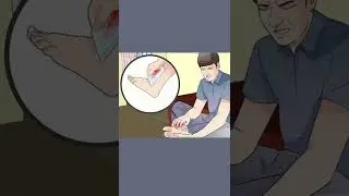 FIRST AID FOR BROKEN BONE