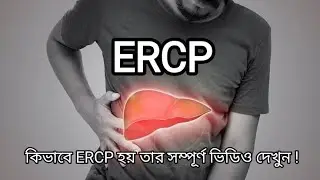 ERCP PROCEDURE || Eedoscopic retrograde cholangiopancreatiography