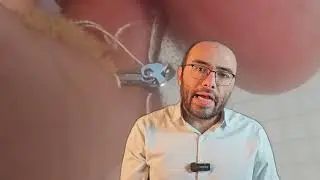 إصلاح ارتجاع الصمام الميترالي بالقسطرة