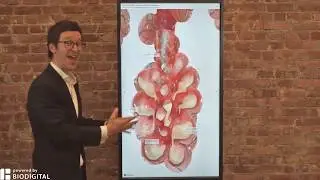 How do you know if you have the coronavirus? - Dr. Tom Talks