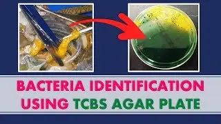 BACTERIA IDENTIFICATION USING TCBS AGAR PLATE! We Show You The Results | RAS Aquaculture