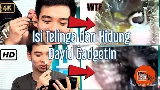Mengintip Isi Telinga dan Hidung David