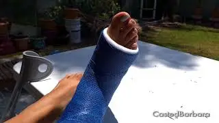 Blue long leg cast (LLC) | Casted Barbara