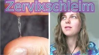 Der Zervixschleim - das wichtigste Eisprungzeichen