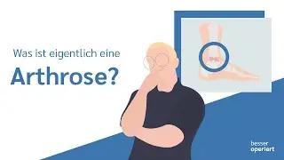 Was ist eigentlich eine Arthrose? 🤓 | besser operiert