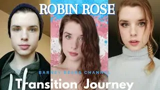 HRT BOY TO GIRL UPDATE TIMELINE/ MEET ONE OF THE MOST  BEAUTIFUL AND SEXY TRANSWOMAN /MS. ROBIN ROSE