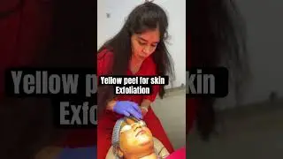 Yellow peel for akin exfoliation at Delhi - 8287001211 !! #peels #peeloff #skincareroutine