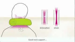 Whiplash - Symptoms and treatment