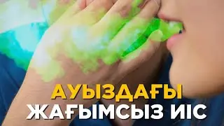 Жағымсыз иіс себептері| НЕ ПРИЯТНЫЙ ЗАПАХ ИЗО РТА