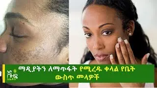 ማዲያትን ለማጥፋት የሚረዱ ቀላል የቤት ውስጥ መላዎች