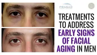 Addressing and Preventing Early Signs of Facial Aging in Men