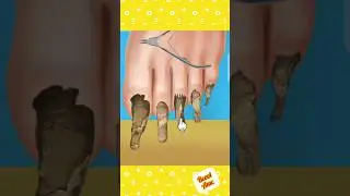 asmr foot nail cleaning shorts👣foot treatment animation asmr#animation#asmr#short