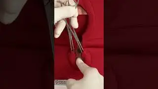 Have you ever struggled with identifying the muscle ends in a complicated repair? 🤓👆