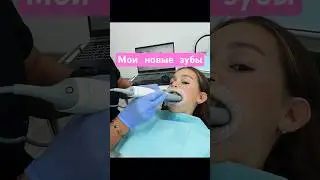 У МЕНЯ НОВЫЕ ЗУБЫ 🦷