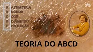TEORIA DO ABCDE