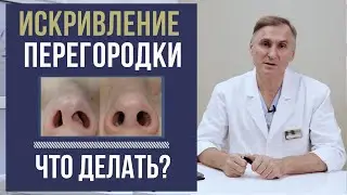 ИСКРИВЛЕНИЕ ПЕРЕГОРОДКИ НОСА ❗️КАК УЛУЧШИТЬ ДЫХАНИЕ?❗️