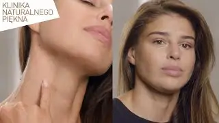 Ania Markowska z "Top Model" postanowiła usunąć bliznę, która przypomina jej walkę z rakiem [KNP]