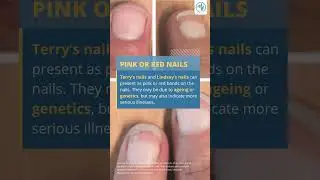 What Does the Colour of Your Nails Say About Your Health | 